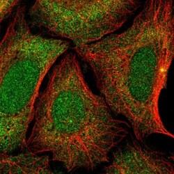 ZNF14 Antibody, Novus Biologicals 25 &mu;L, Unlabeled:Antibodies, Polyclonal